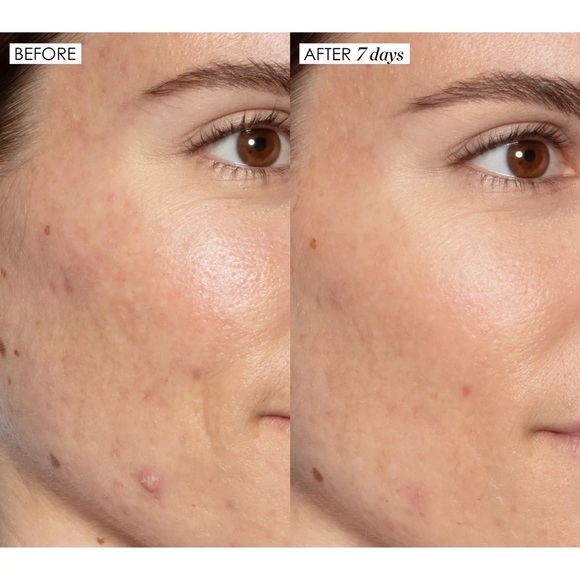 NEW Sunday Riley Good Genes All-In-One Lactic Acid Treatment - Picture 6 of 13